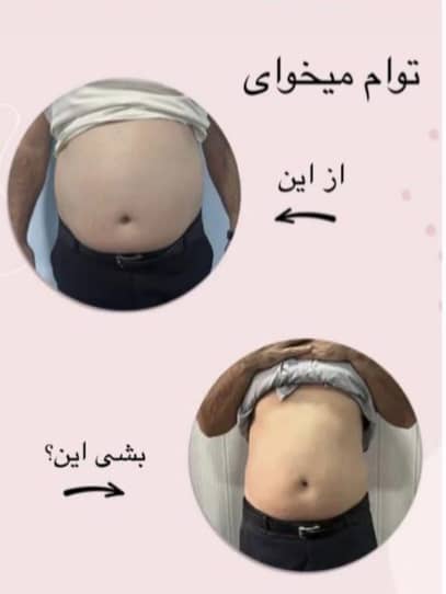 کلینیک پزشکی و زیبایی پوست مو سایه در نواب رشت